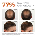 BosleyMD Revive Color Safe Shampoo & Conditioner (25 fl. oz., 2 pk.)