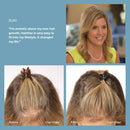 HairMax Ultima Classic LaserComb Bundle Medical Hair Growth Device