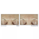 RoC Derm Correxion Fill + Treat Serum (0.34 fl. oz. + 2 - 0.34 fl. oz. refills)