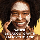 St. Ives Acne Control Apricot Scrub (6 oz., 3 pk.)